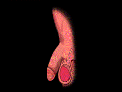 怎么判断男性阳痿? 怎么判断男性阳痿?