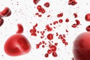 警惕血尿 危害不一般! 警惕血尿 危害不一般!