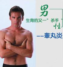 河池睾丸炎治疗哪家医院好?