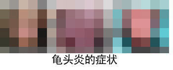 河池龟头炎检查哪家医院好? 河池龟头炎检查哪家医院好?