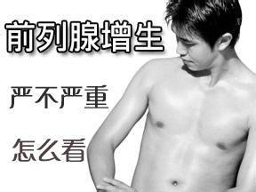 导致前列腺增生的原因有哪些? 导致前列腺增生的原因有哪些?