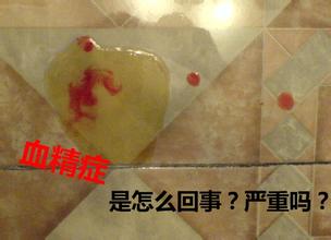 血精症的症状有哪些? 血精症的症状有哪些?